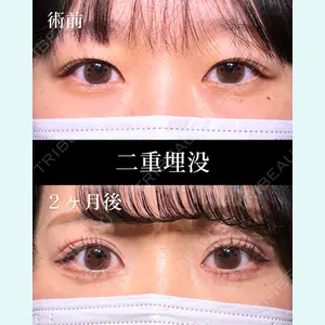 症例
