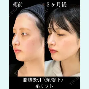 症例