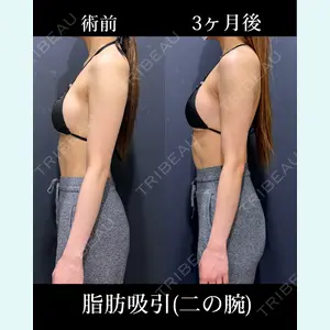 症例