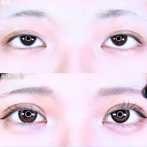 症例