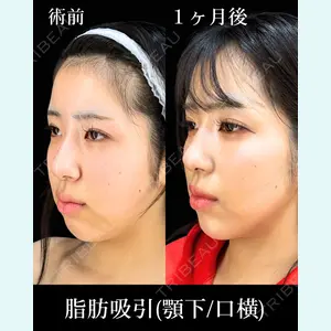 症例
