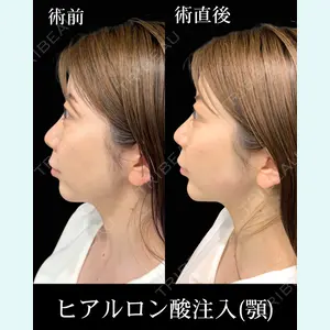 症例