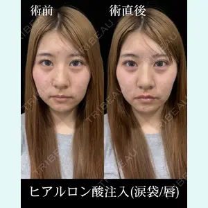 症例