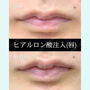 症例