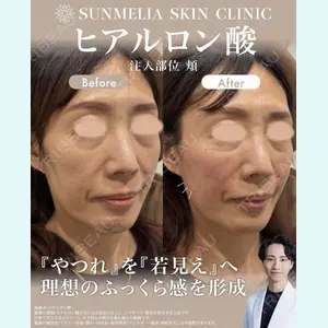 症例