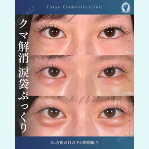 症例