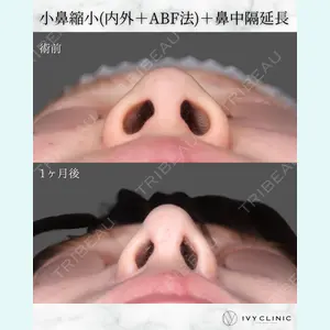 症例