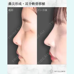 症例