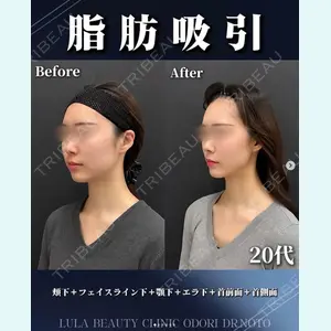 症例