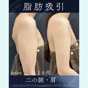 症例