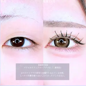 症例