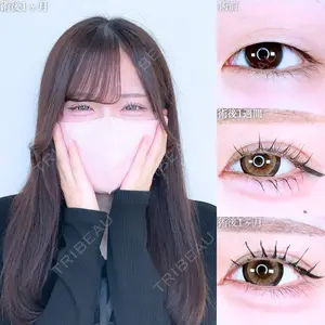 症例