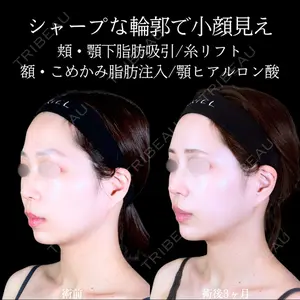 症例