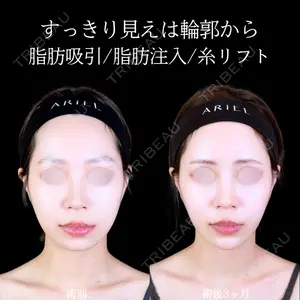 症例