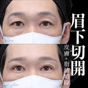 症例