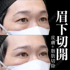 症例
