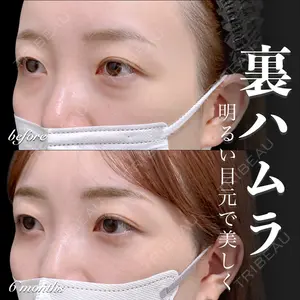 症例