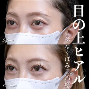 症例