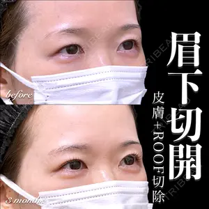 症例