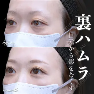 症例