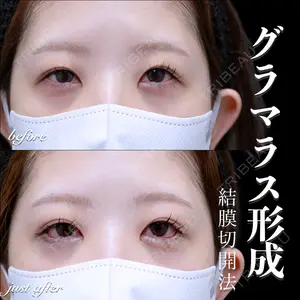 症例