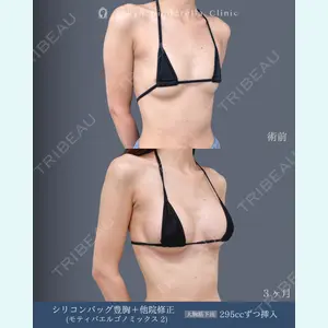 症例