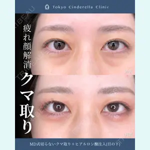 症例
