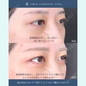 症例