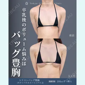 症例