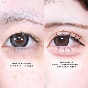 症例