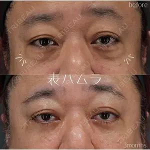 症例