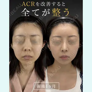 症例
