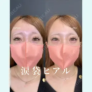 症例