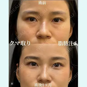 症例
