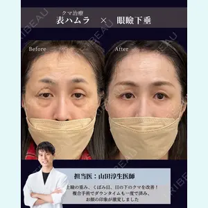症例