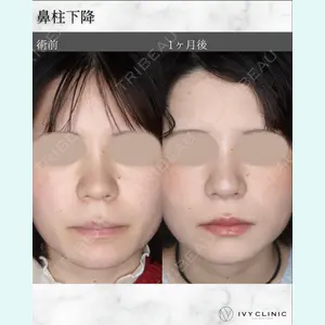 症例