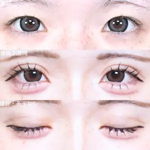 症例