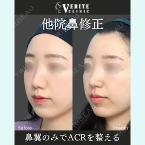 崔 乘奎医師の症例
