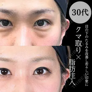 症例
