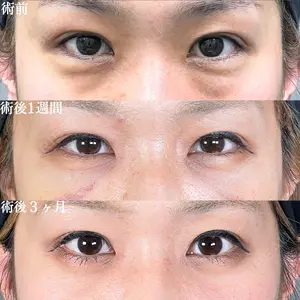 症例
