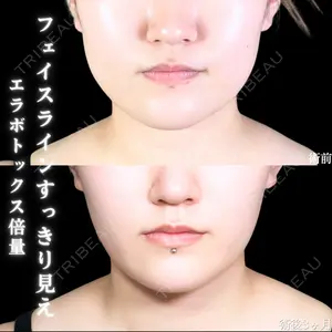 症例