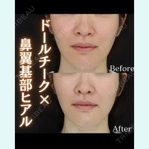 症例