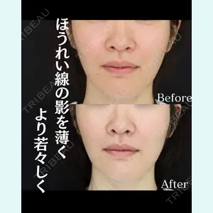 症例