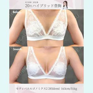 症例