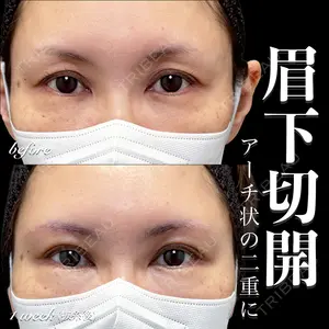 症例