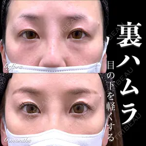 症例