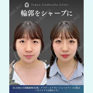 症例