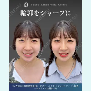 症例