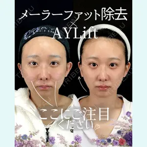 症例