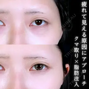 症例